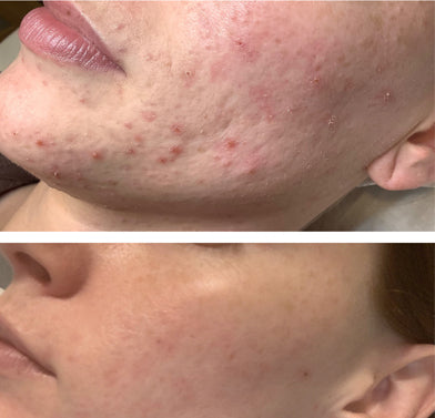 It Girl Skin – Skin Food